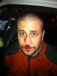 Zimmerman on the night of his altercation with Martin. Creative Commons License.